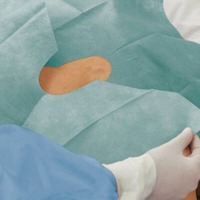 Χειρουργικό Πεδίο 2ply Αυτοκόλλητο με Μεταβαλλόμενη Οπή Foliodrape